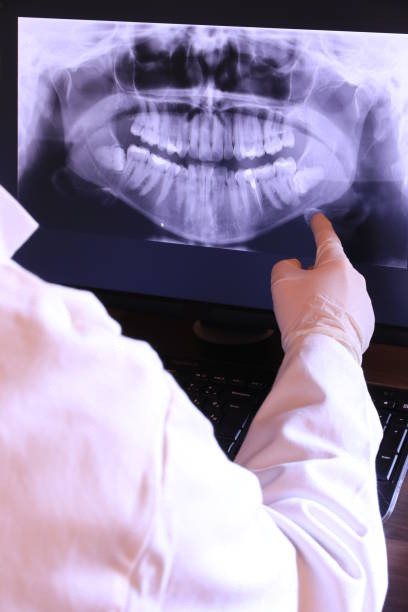 Best Same-Day Emergency Dentist in Johnstonville, CA